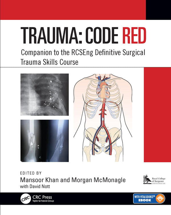 Trauma: Code Red: Companion to the RCSEng Definitive Surgical Trauma Skills Cour by Mansoor Khan - used book at Perkology Books