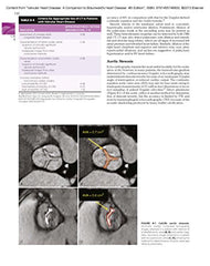 Valvular Heart Disease: A Companion to Braunwald's Heart Disease