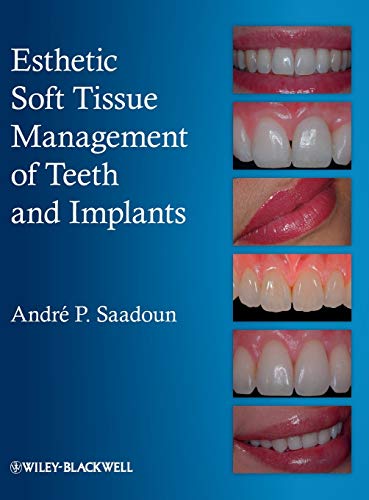 Esthetic Soft Tissue Management of Teeth and Implants – Perkology Books