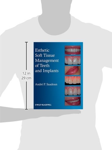 Esthetic Soft Tissue Management of Teeth and Implants