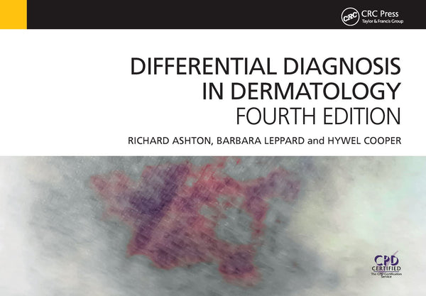 Differential Diagnosis in Dermatology by Richard Ashton
