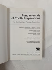 Fundamentals of Tooth Preparations for Cast Metal and Porcelain Restorations