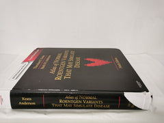 Atlas of Normal Roentgen Variants That May Simulate Disease: Expert Consult