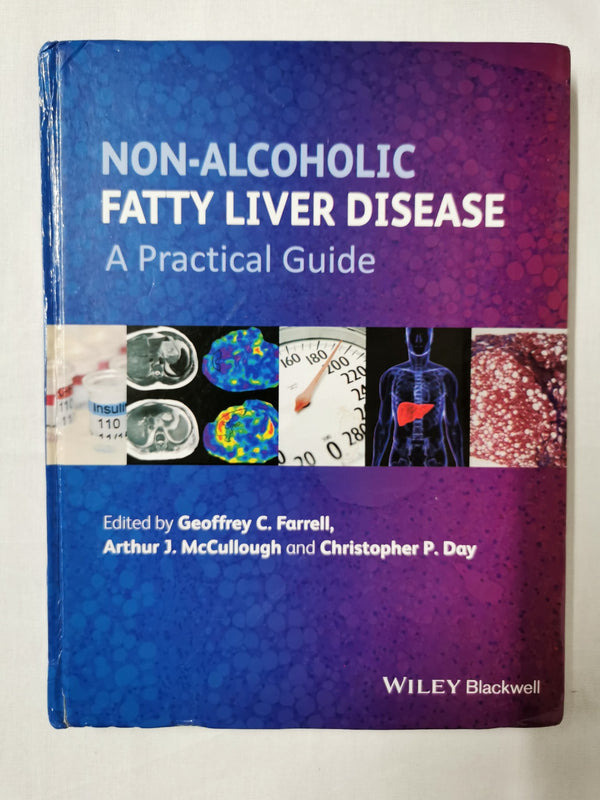 Non-Alcoholic Fatty Liver Disease: A Practical Guide