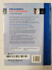 Non-Alcoholic Fatty Liver Disease: A Practical Guide