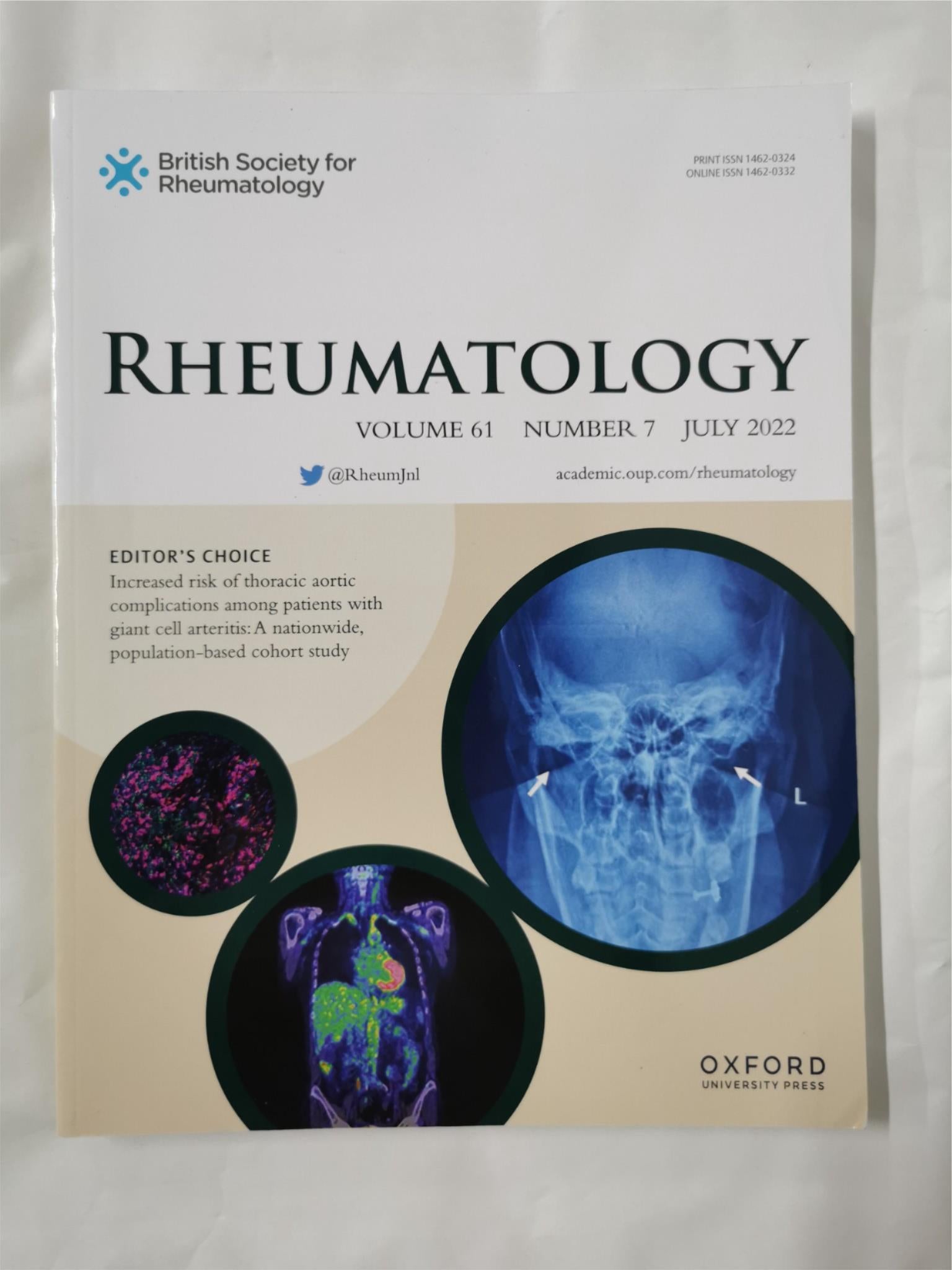 Rheumatology Volume 61, Number 7, July 2022 ISSN 1462-0324 – Perkology ...